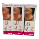 Three boxes of Similia Face Care Tablets for black spots and discoloration of face on a white background.